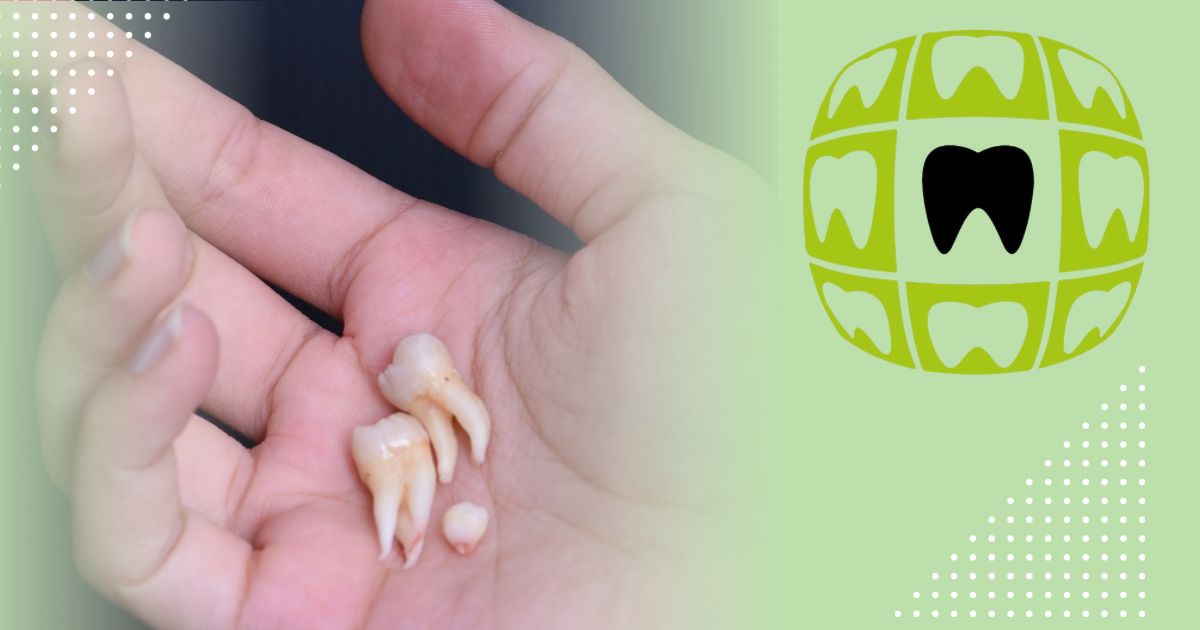 Antalya Diş Çekimi Tooth Extraction in Turkey