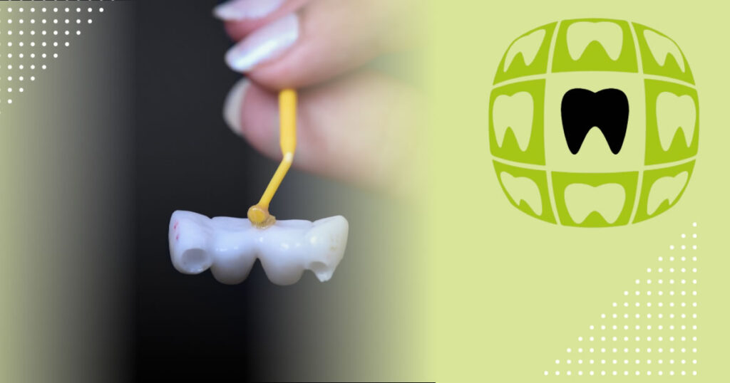 Antalya köprü diş tedavisi Dental Bridge Treatment in Turkey